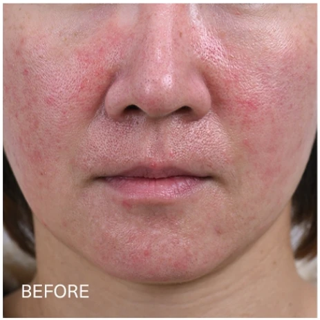 before_image