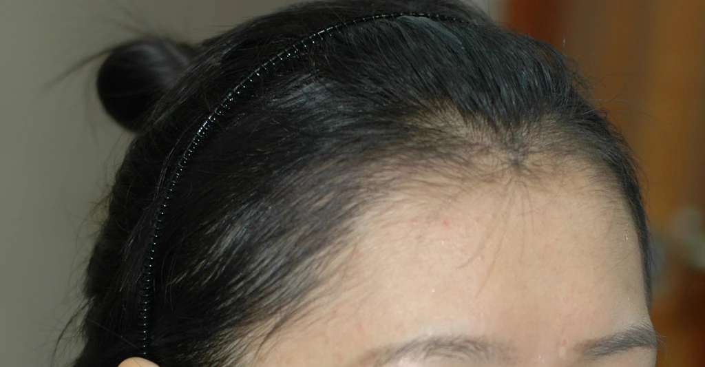 before_image