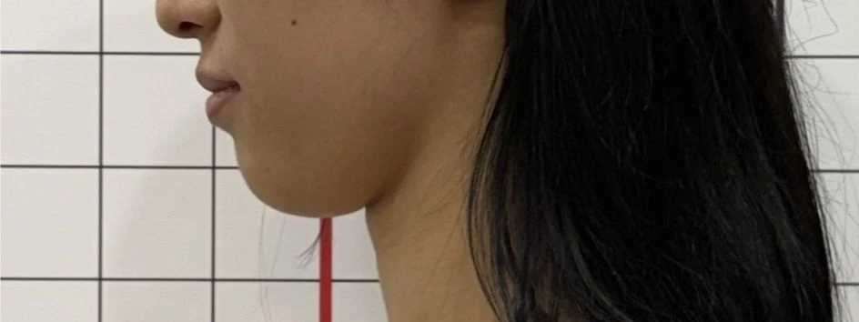 before_image