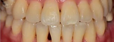 before_image