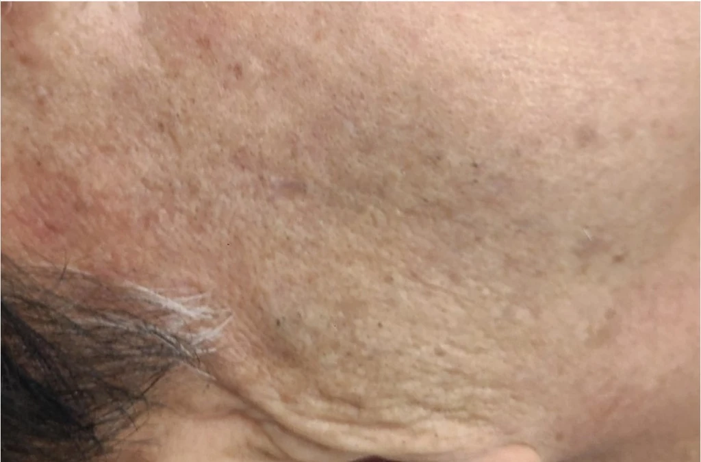 before_image