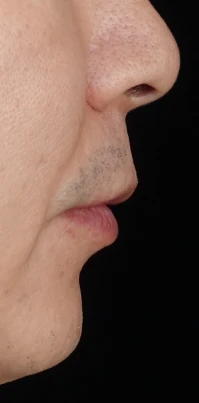 before_image