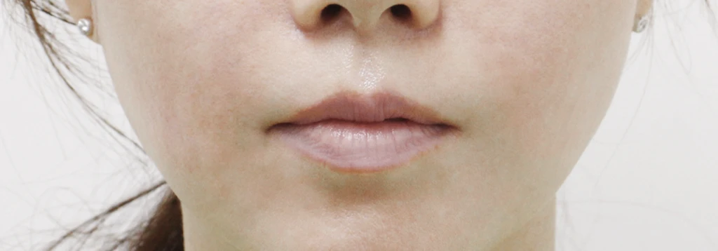 before_image