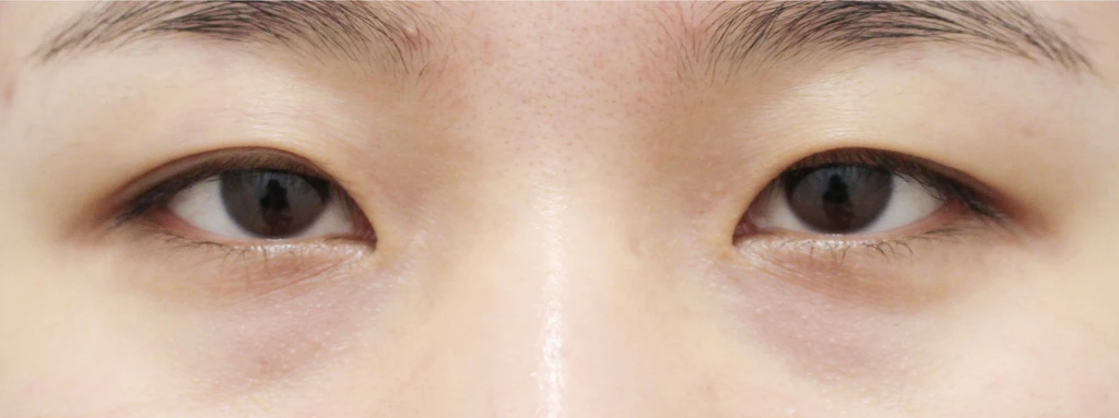 before_image