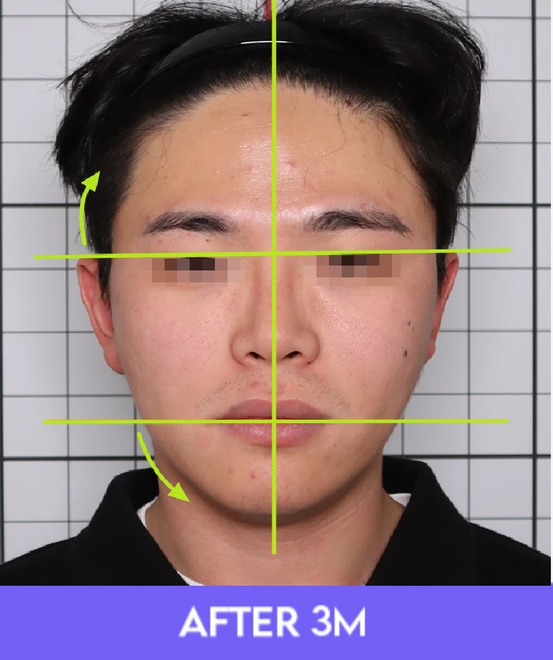 before_image