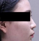 before_image