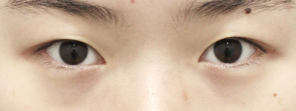 before_image