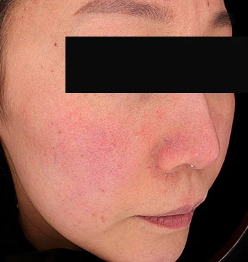 before_image