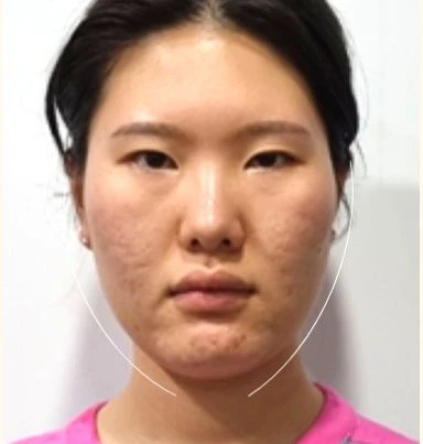 before_image