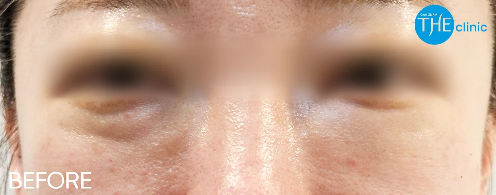 before_image