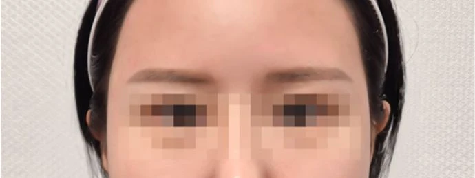 before_image