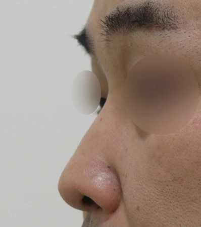before_image