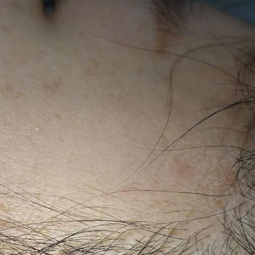 before_image