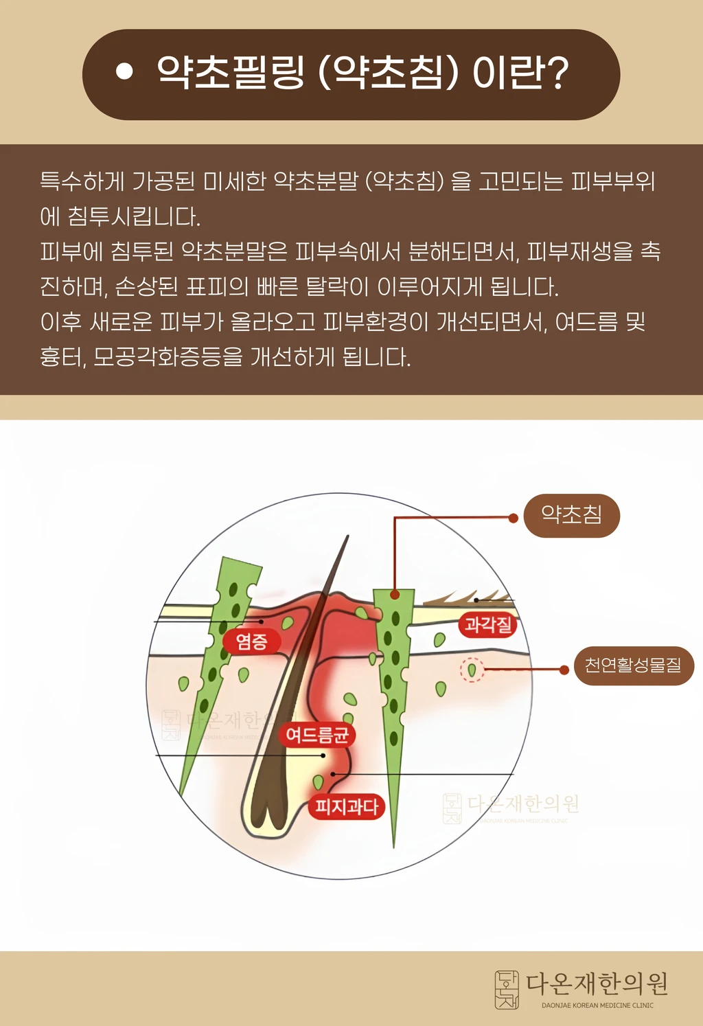 treatmentIntroduction