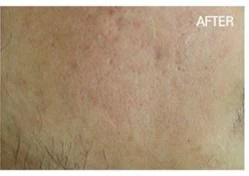 before_image