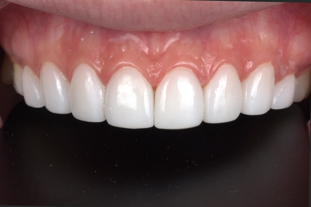 before_image