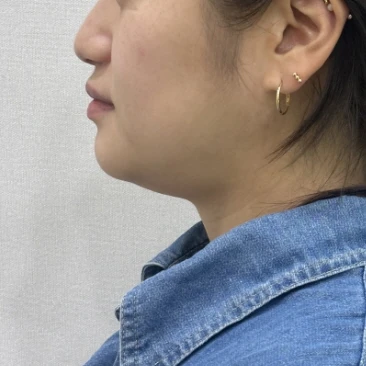 before_image