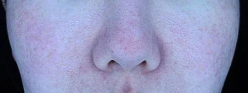 before_image