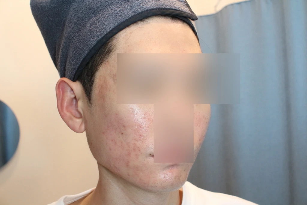 before_image