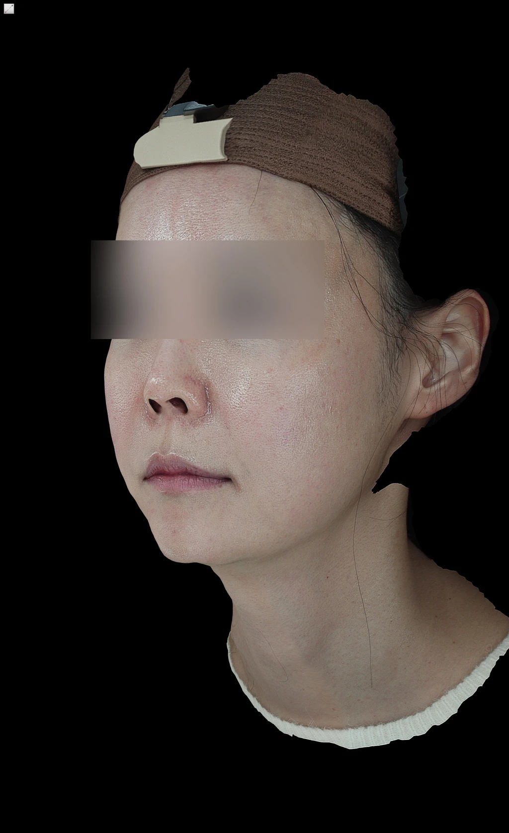 before_image