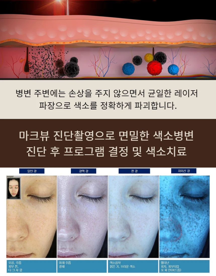 treatmentIntroduction