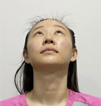 before_image
