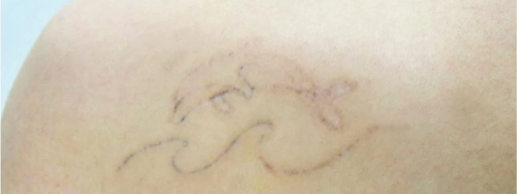 before_image
