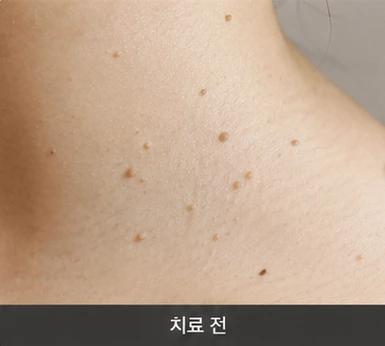 before_image