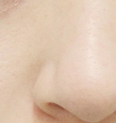 before_image