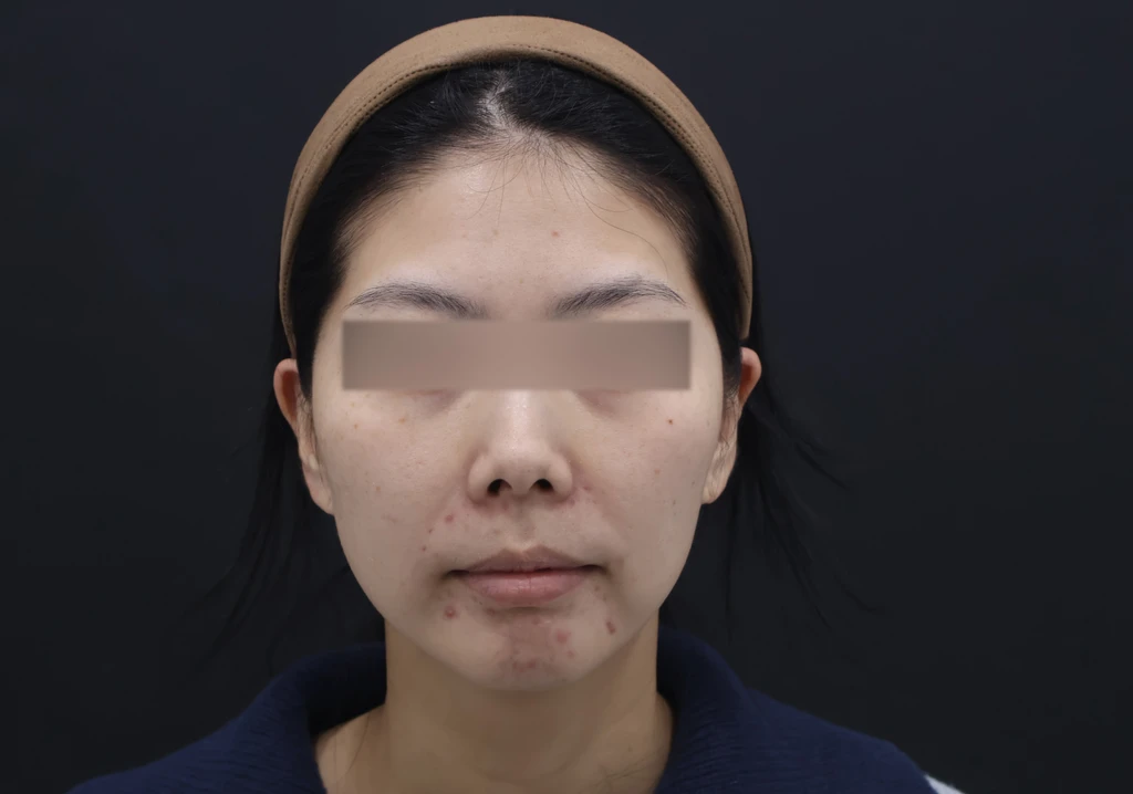 before_image