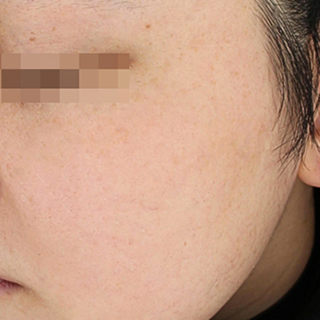 before_image