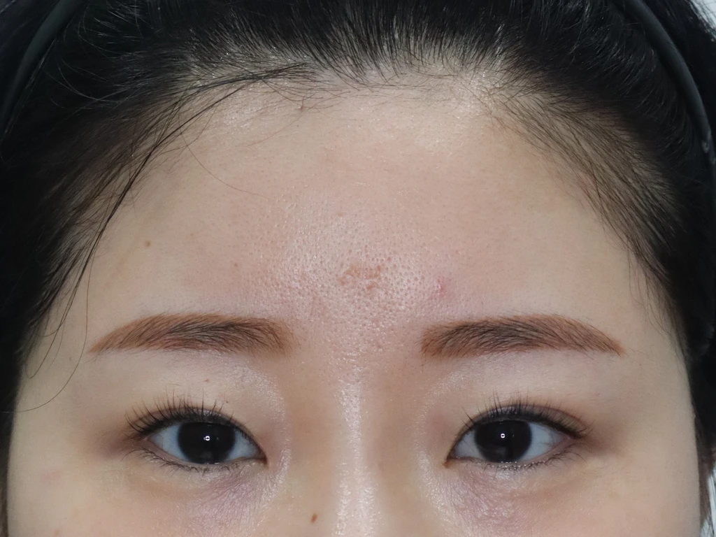 before_image