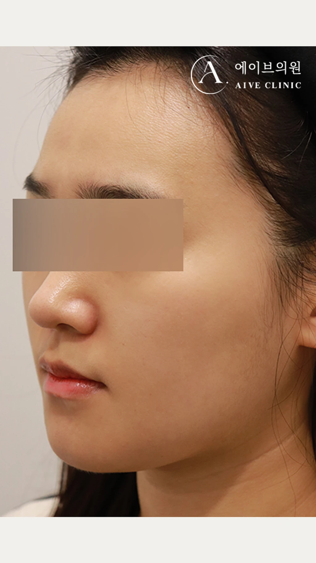 before_image
