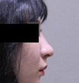 before_image
