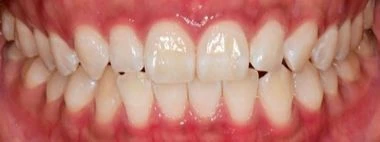 before_image