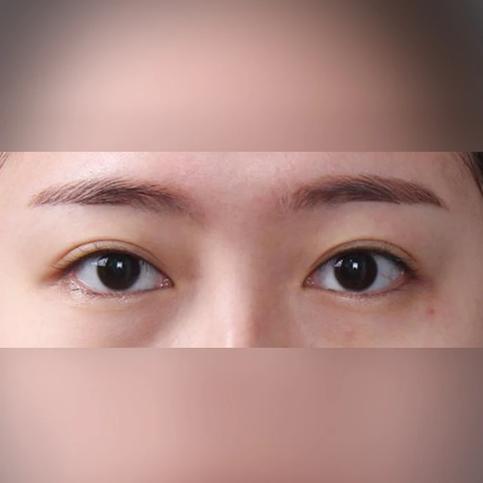 before_image