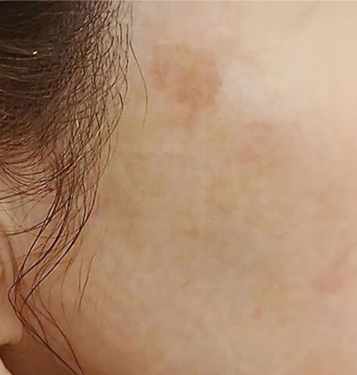 before_image