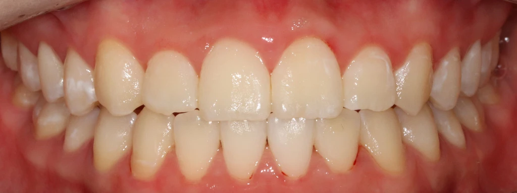 before_image