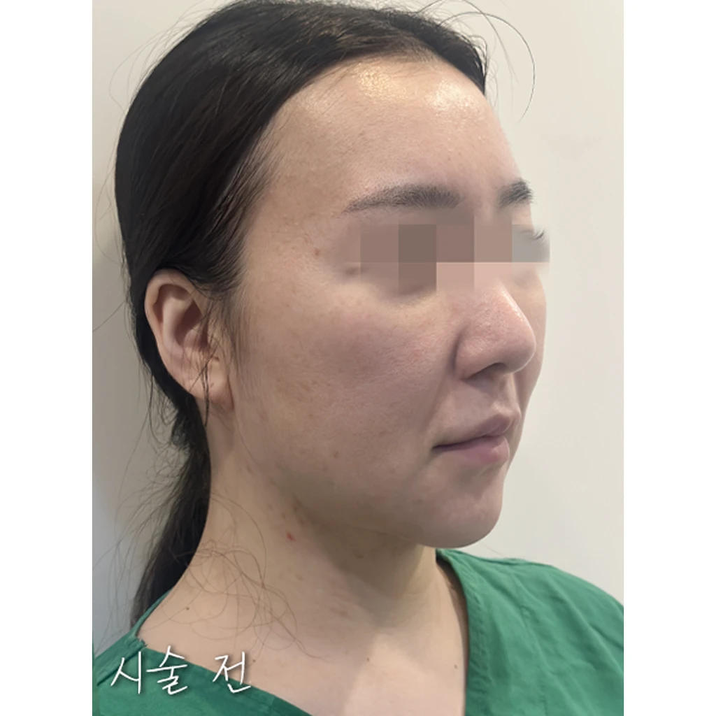 before_image