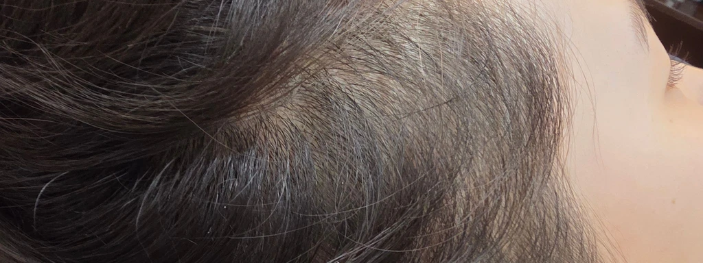 before_image