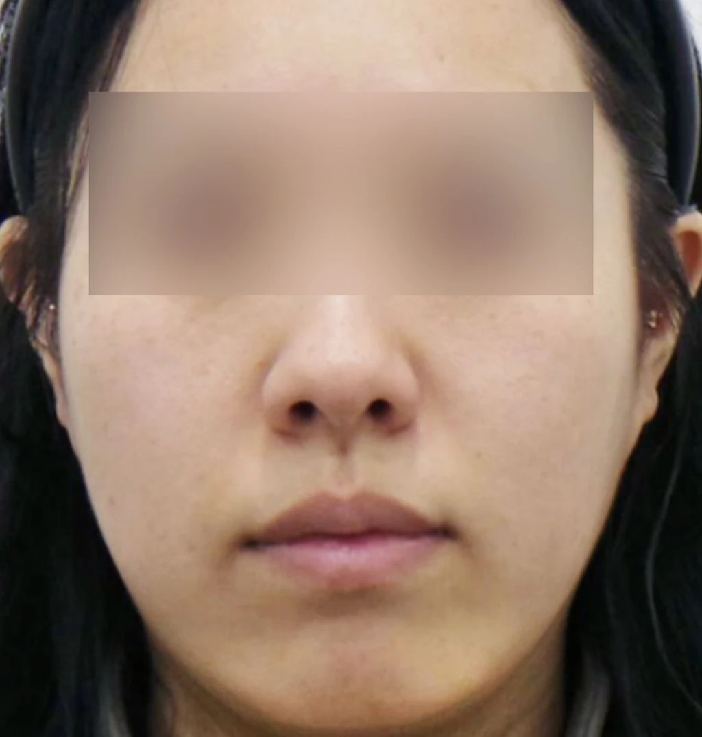 before_image