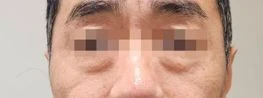 before_image