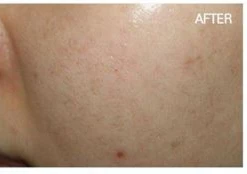 before_image