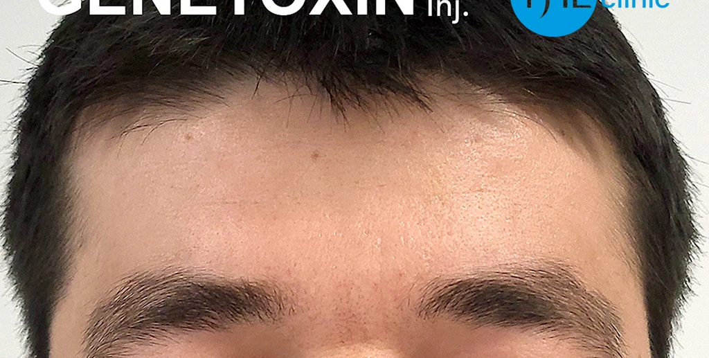 before_image