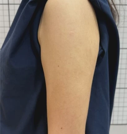 before_image