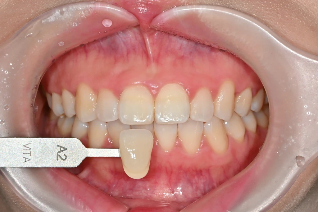 before_image