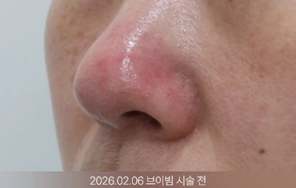 before_image
