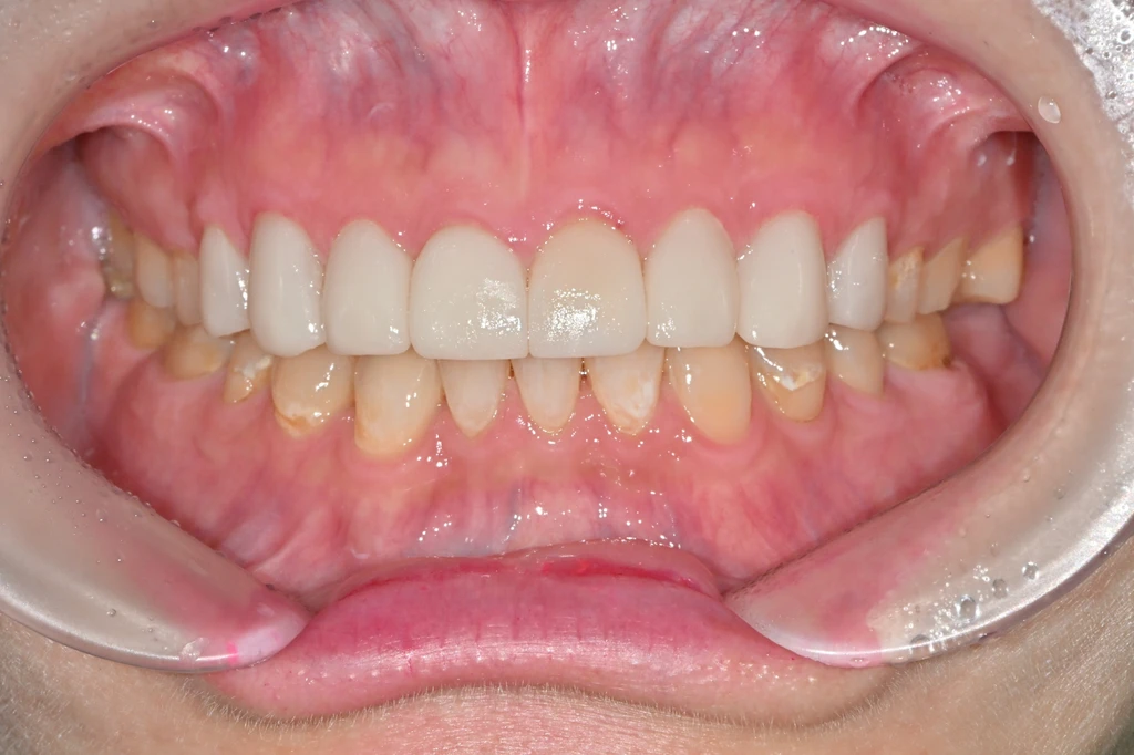 before_image