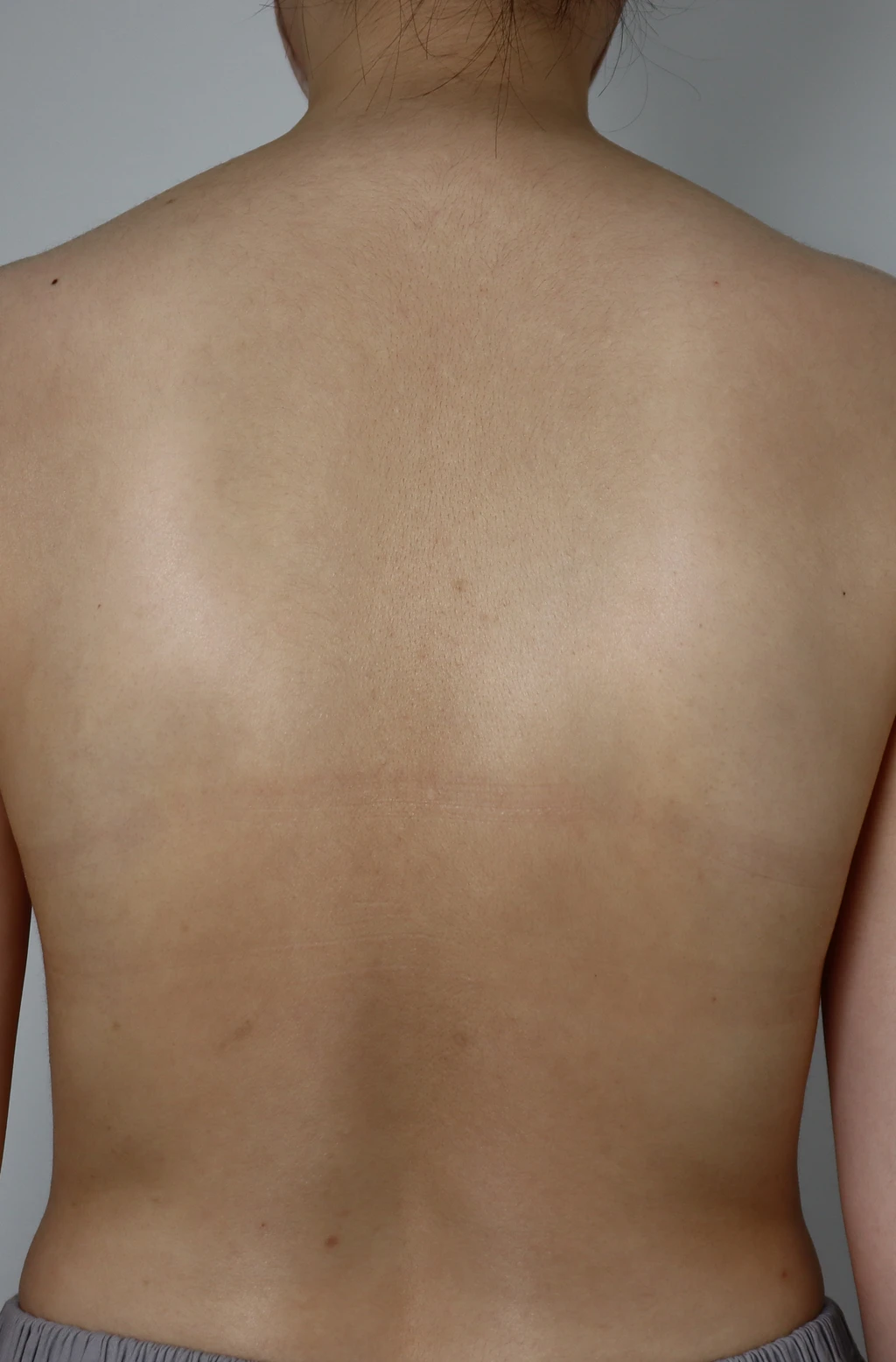 before_image