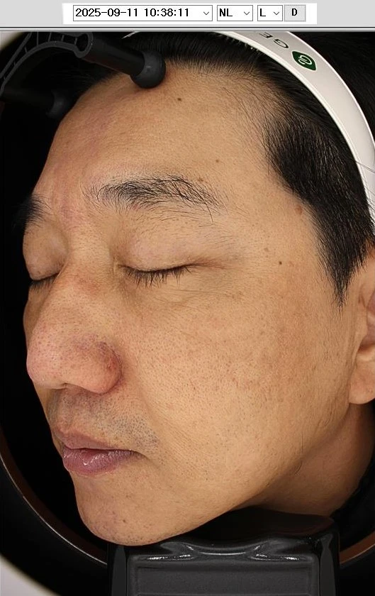 before_image